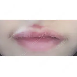 3日目の経過画像（1枚目）