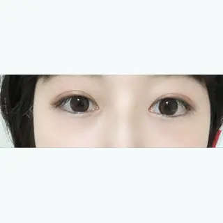 51日目の経過画像（1枚目）