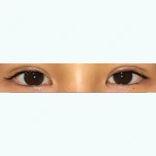 7日目の経過画像（1枚目）