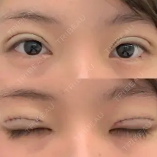 0日目の経過画像（1枚目）