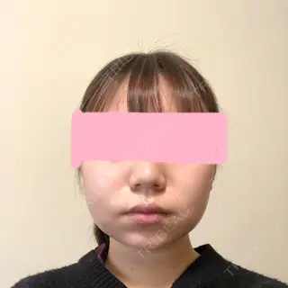 2日目の経過画像（1枚目）