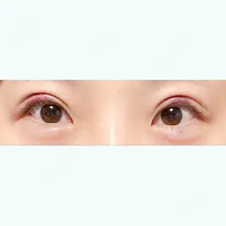 1日目の経過画像（1枚目）