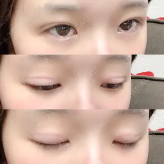 8日目の経過画像（2枚目）