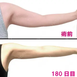180日目の経過画像（2枚目）