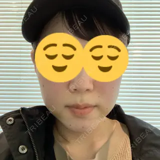3日目の経過画像（1枚目）
