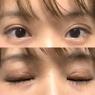 10日目の経過画像（1枚目）
