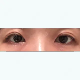 24日目の経過画像（1枚目）