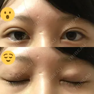 7日目の経過画像（1枚目）