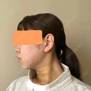 3日目の経過画像（3枚目）