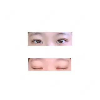 18日目の経過画像（1枚目）