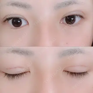 2日目の経過画像（1枚目）
