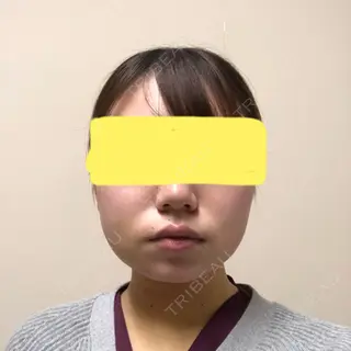 4日目の経過画像（1枚目）