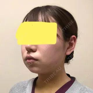 4日目の経過画像（3枚目）