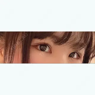11日目の経過画像（3枚目）