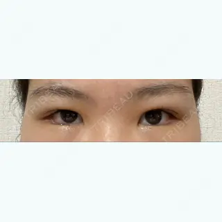 18日目の経過画像（1枚目）
