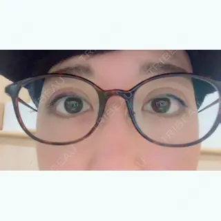 2日目の経過画像（3枚目）