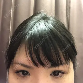 2日目の経過画像（1枚目）