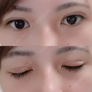 2日目の経過画像（1枚目）