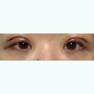 1日目の経過画像（1枚目）