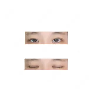 21日目の経過画像（1枚目）