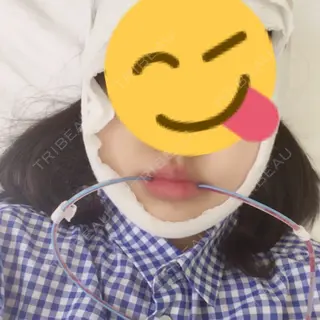 2日目の経過画像（1枚目）