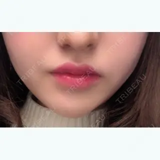 1日目の経過画像（1枚目）
