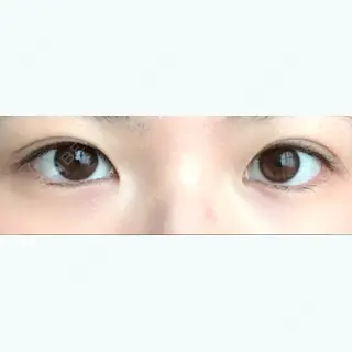 70日目の経過画像（1枚目）