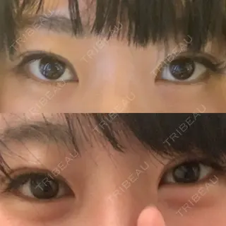 10日目の経過画像（1枚目）