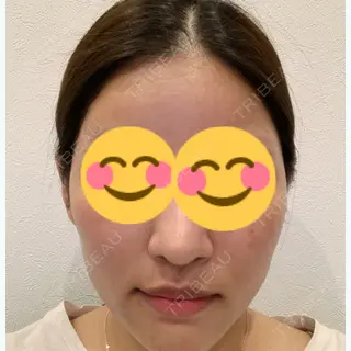6日目の経過画像（1枚目）