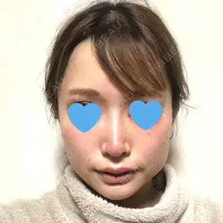 8日目の経過画像（1枚目）