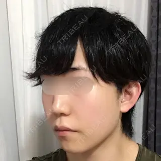8日目の経過画像（3枚目）