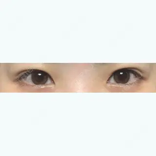 25日目の経過画像（1枚目）
