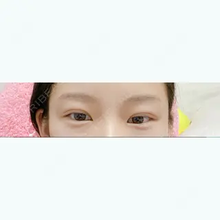 9日目の経過画像（2枚目）