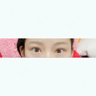 9日目の経過画像（1枚目）