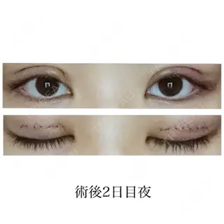2日目の経過画像（1枚目）