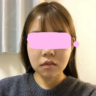 8日目の経過画像（1枚目）
