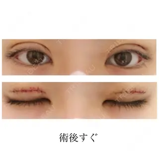 0日目の経過画像（1枚目）