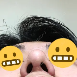 59日目の経過画像（3枚目）