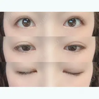 158日目の経過画像（1枚目）