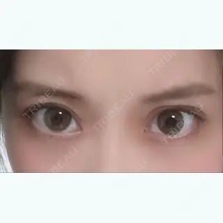 39日目の経過画像（1枚目）