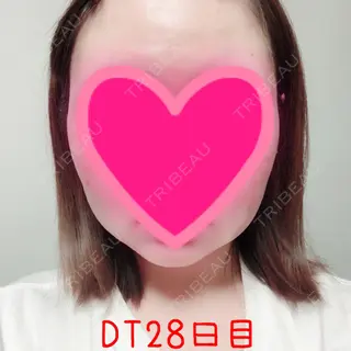 28日目の経過画像（1枚目）