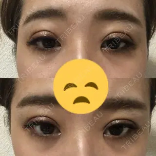 6日目の経過画像（2枚目）