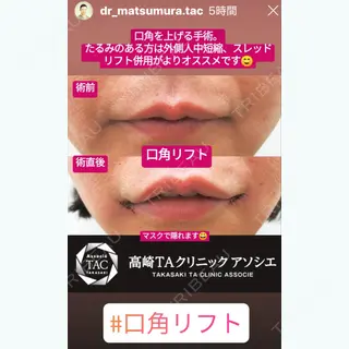 5日目の経過画像（1枚目）