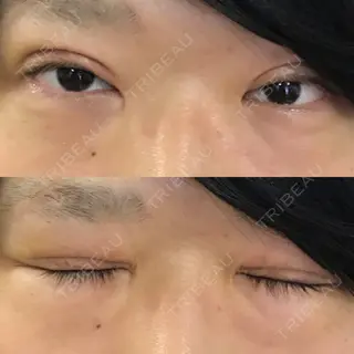 9日目の経過画像（1枚目）