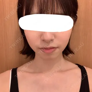 4日目の経過画像（1枚目）
