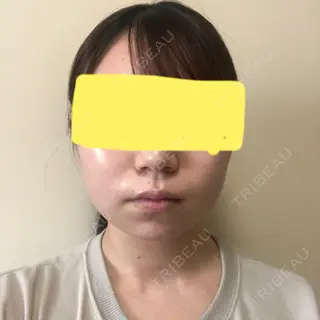 12日目の経過画像（1枚目）