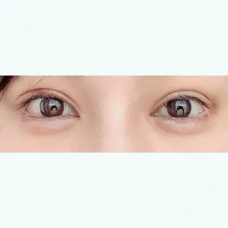 7日目の経過画像（1枚目）