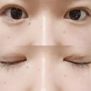 7日目の経過画像（1枚目）