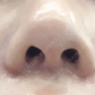 8日目の経過画像（2枚目）