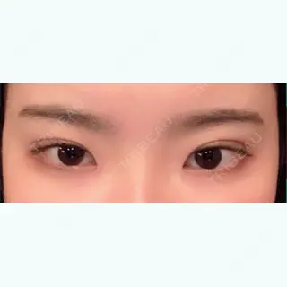 7日目の経過画像（1枚目）